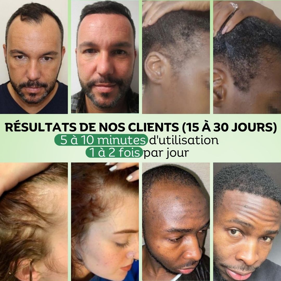 Pack Hydratation & Repousse Vivaci